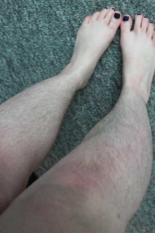 hairylegsclub: I stopped shaving in October 2014 and I’m really hoping I can get the courage t