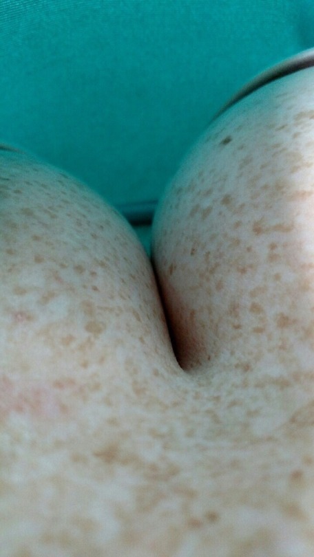 d-3-s-i-g-n:Freckles 😍