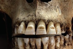 theoddcollection:  Viking men were also heavily tattooed but their most striking and fearsome fashion statement was their gnashers.  They would file horizontal lines into the enamel on their front teeth and paint in red resin. Gareth Williams (curator