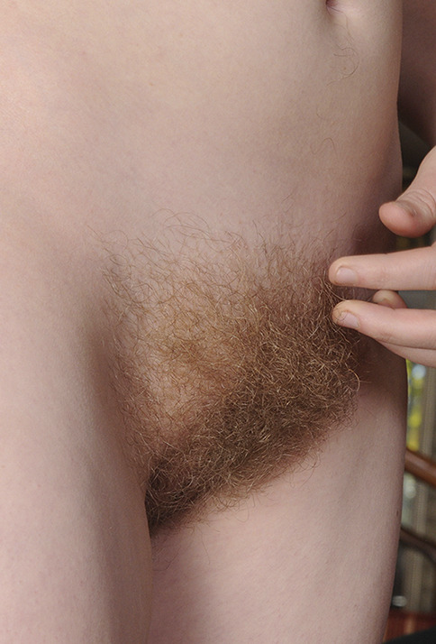 lovemywomenhairy:  Classy, Sassy and Hairy too!! - II 