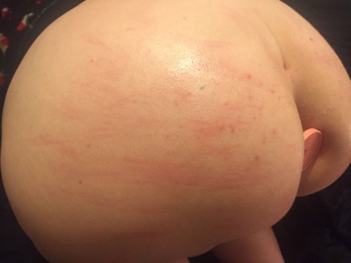 daddiesfuckslave: I begged Daddy to whip my ass hard with some sticks we found. We taped some thick ones together and went to town.  Maybe I should’ve have begged so convincingly, thank god he was distracted with thoughts of fucking my asshole deep