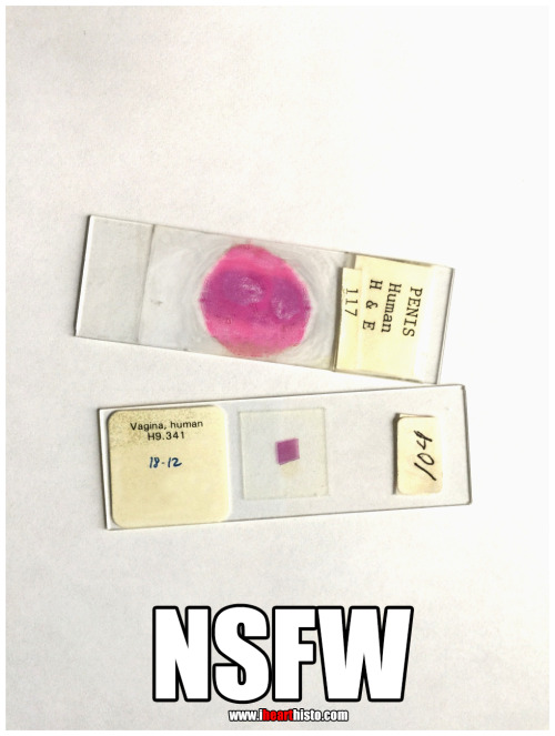 i-heart-histo:  NSFW Cover your eyes kids. i♡histo 