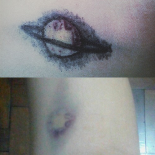 murderyourjoy:This is a bruise. I made Saturn out of it.