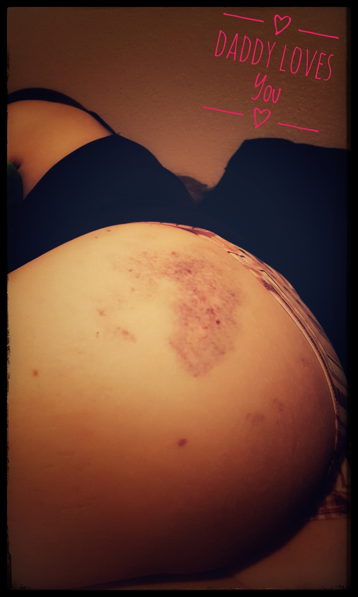 A Daddy&rsquo;s loveA Daddy&rsquo;s ReleaseThe bruises I make create a place