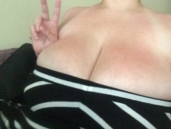 sppersonalblog:  my boobs aren’t as burnt as my back is, but I know you guys aren’t interested in pictures of my back lmao
