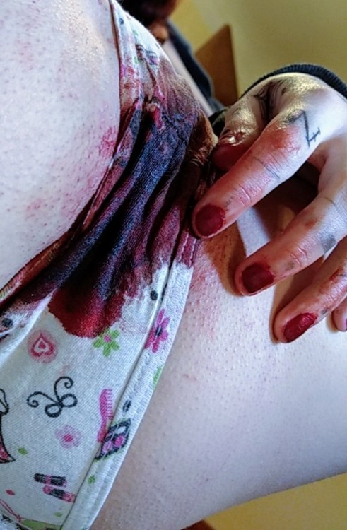 bloodplay