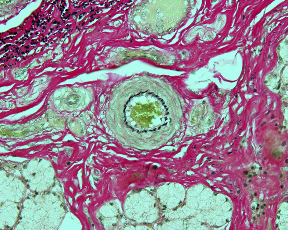 Simply Histology — Oesophagus
