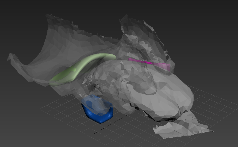 anthroanim:  I guess this qualifies at the very first useful use of the 3D printer.