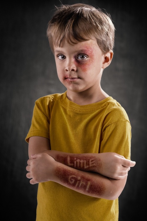 the-promised-wlan: tonytobar: What if verbal abuse left the same scars as physical abuse? Would it b