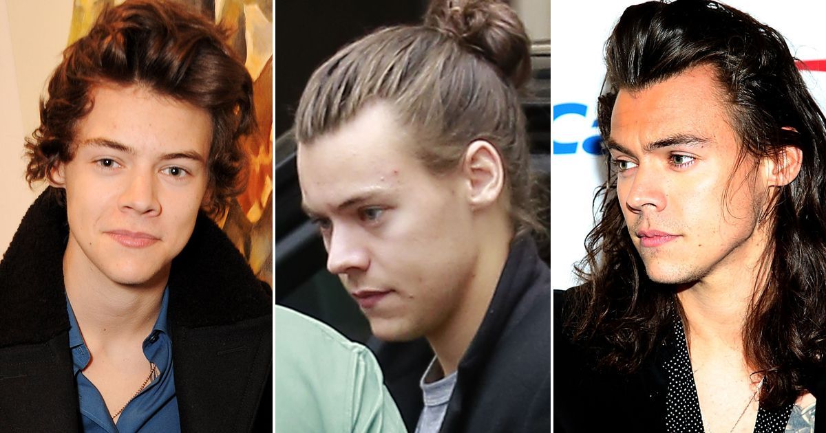 . - Is Harry Styles losing his hair? One Direction star  reveals receding hairline