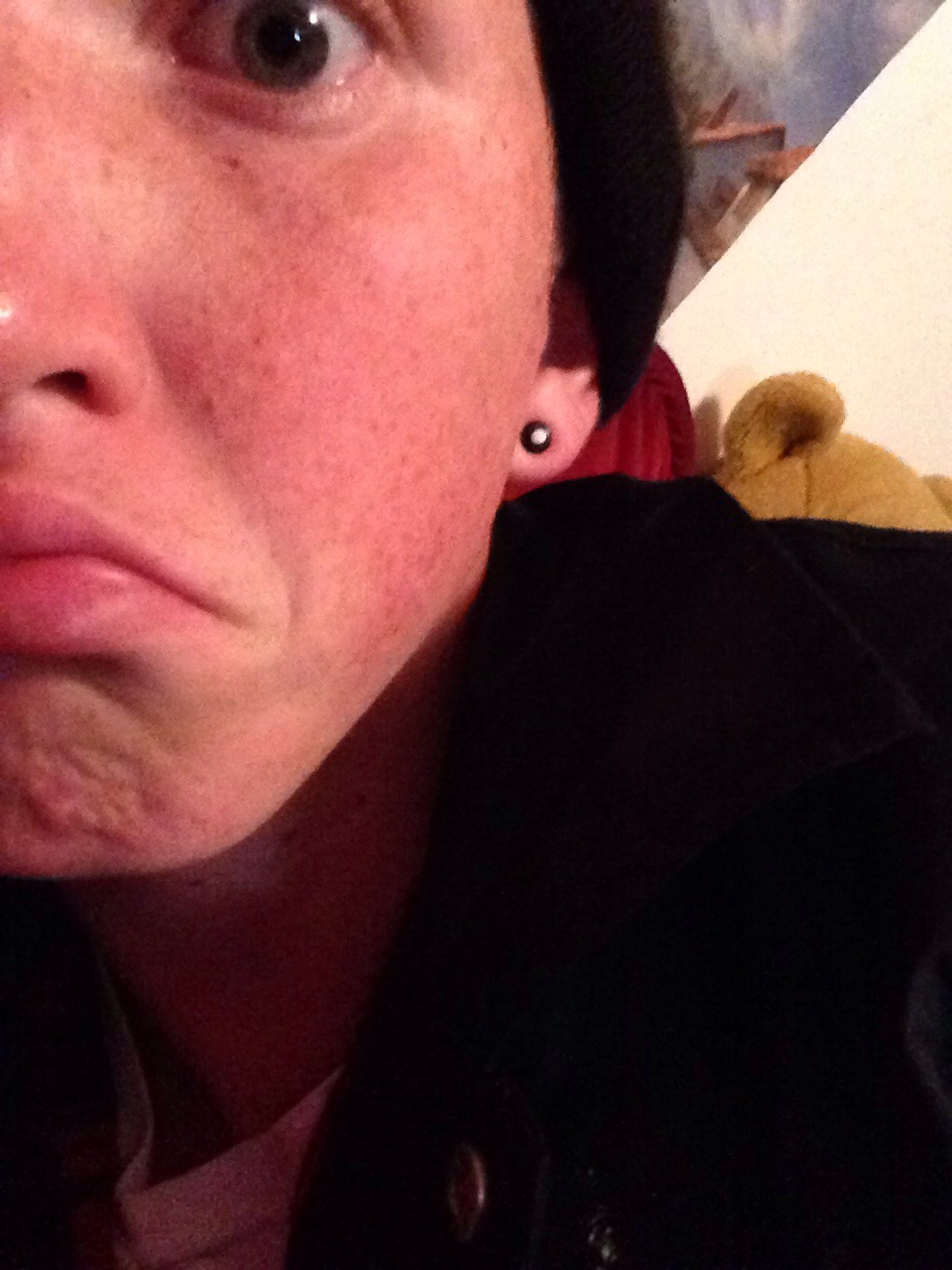 sebbielikesbikes:  Freckles suck  Not true at all.  &quot;A face without freckles