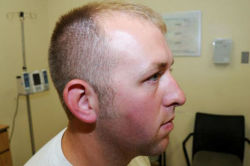 faultingthestars:  geoffreytoday:  So these are the grand jury photos. These are the photos of Darren Wilson’s “injuries”. Injuries that I can’t see. Can you? What injuries should we be seeing? Well, according to his testimony to the Grand Jury,