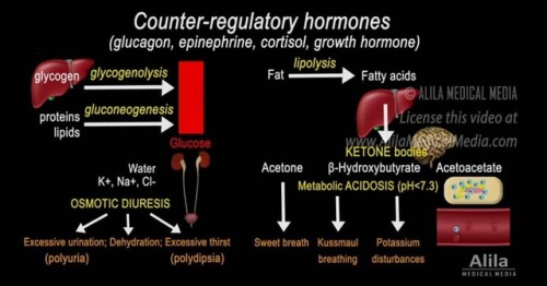 Diabetic ketoacidosis.Knowing the exact metabolism.#mednotes #medschool #medstudent #medicine #blood