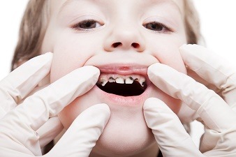 Consider Taking Your Child to the Orthodontist
A consultation with an orthodontist can provide several advantages for your child:
- Experts recommend that children have an orthodontic evaluation before their 7th birthday to ensure that any problems...