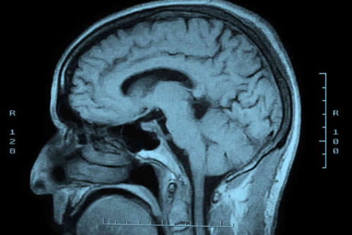 MRI Technology Detects Diseases In Seconds Rather Than Hours - PSFK
A typical MRI body scan is a difficult process which involves lying motionless in a tight space often for hours at a time. Imagine if that time could be shortened not only to...