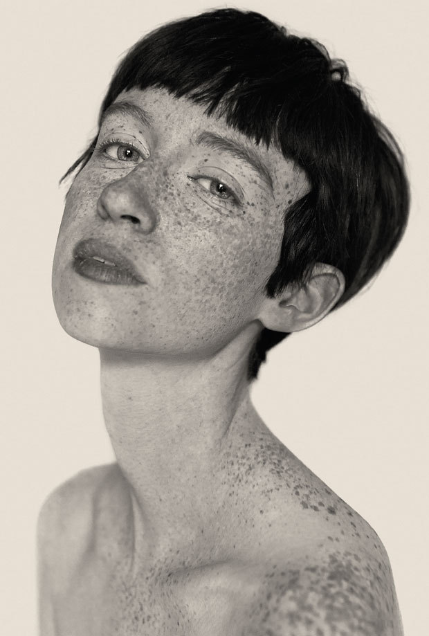 s0mmerspr0ssen:   For his recently published picture book Freckles (Splice Pictures