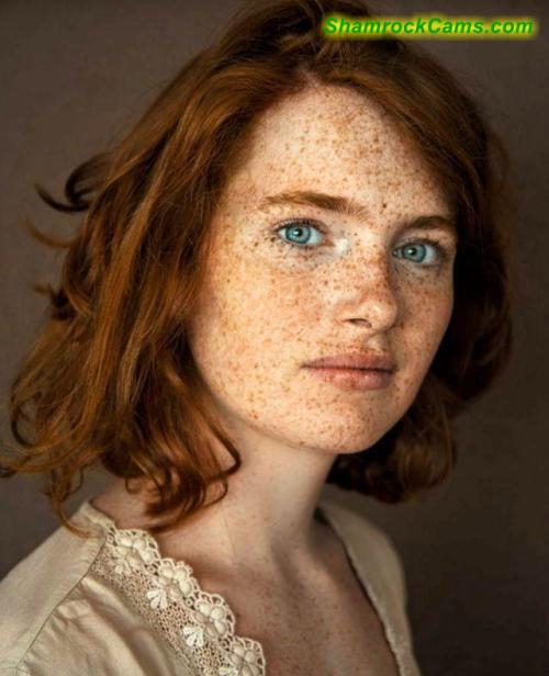 frecklesadmirer: Freckles Admirer