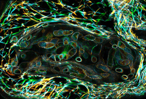 Larvae from the parasitic worm that causes schistosomiasis | ZEISS Microscopy The parasitic worm tha