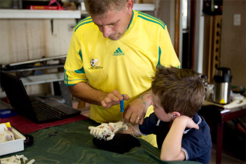 NPR is featuring a wonderful story of a fortuitous meeting between two men from South Africa and United States that led to the development of a prosthetic for kids with congenital deformities. Richard Van As of Johannesburg lost his fingers to a...