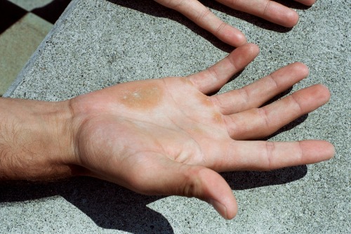  Hands of Roger Federer (2001) by Lukas Wassmann 