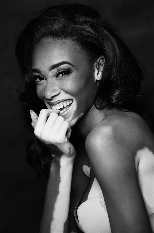 thefashionyoleauxist:Chantelle Brown-Young / Winnie Harlow.