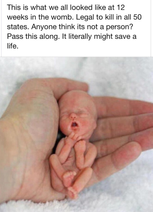 lets-go-lesbos:  provoice:  the-enchanted-story-of-us:  This breaks my heart. Please reblog.  False.  This^ is what you look like at 12 weeks in the womb. This photo will not “save a life” - it only shames women who have had an abortion. And that’s