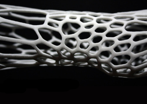 3D printed exoskeletal cast by Jake Evill. More info.