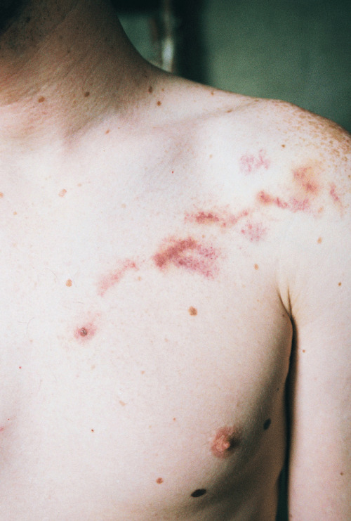 his-bare-bones:by milkweedmouth