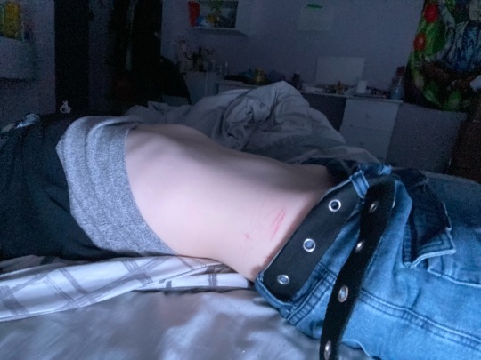 Tumblr media