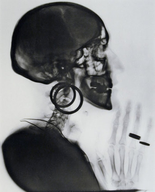  Negative of X-Ray of Meret Oppenheim’s Skull, 1964 