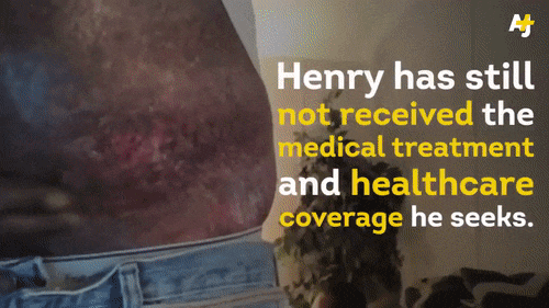 thingstolovefor:  U.S. Military Tested Chemical Weapons on WWII Soldiers by Race