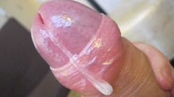 wwwpenissizematters:  Huge drooling uncut cock head 