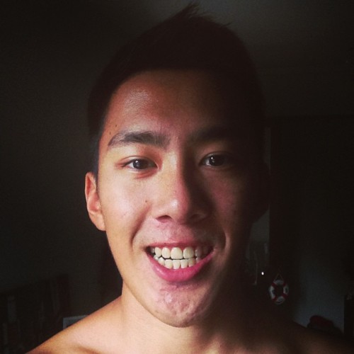 nichlim:  And off goes the braces! 😊 