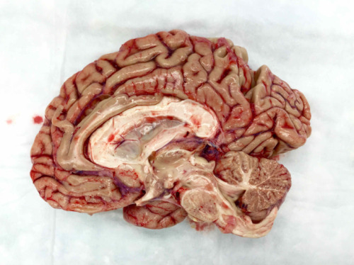 egosumdaniel: Mid Sagittal dissection of a human brain. Absolutely amazing!