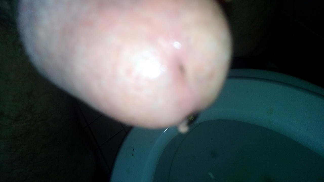 pissen