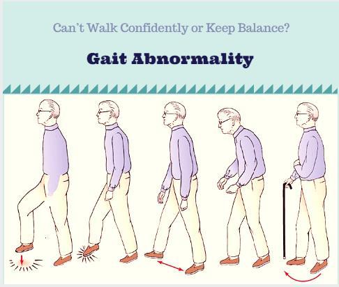 Can’t Walk Confidently Or Keep Balance? Learn About Gait Abnormality By Dr. Vishal Jogi, Neurologist In Ahmedabad.