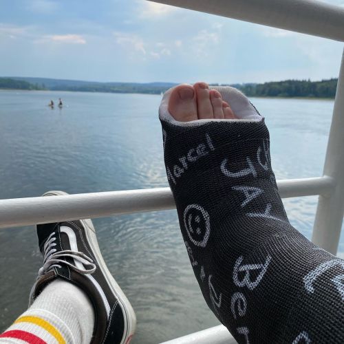 My Cast-buddy comes over for summertime casting. We did a little boat-trip&hellip;. #legcast#bro