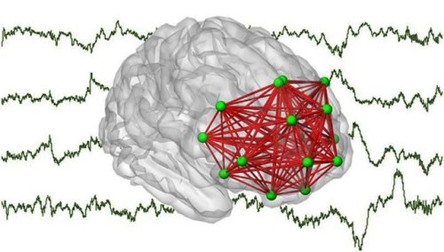 Preterm birth leaves its mark in the functional networks of the brain Researchers at the University 