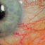 anserineskin