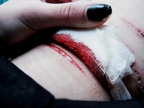 hellosuicidedream:  .
