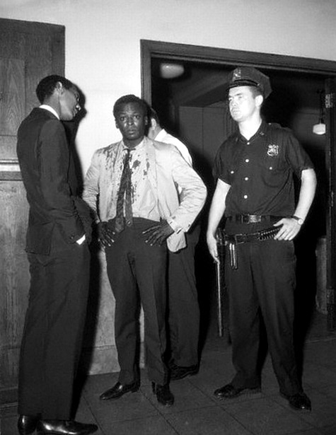 Miles Davis covered in blood after an altercation with police &ldquo;Altercation&rdquo;