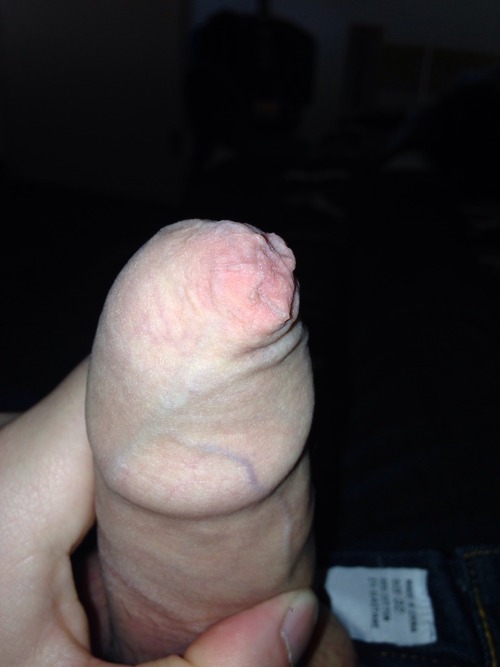 Porn Pics Foreskin smell