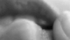 cherry-posts: