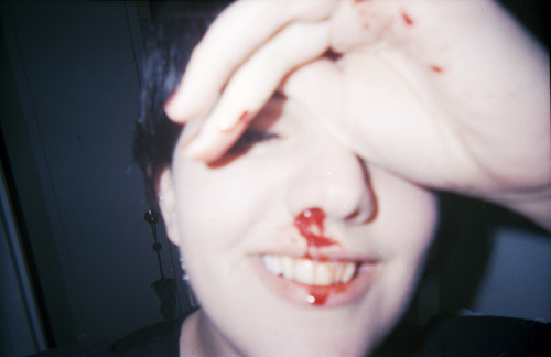 Bloody by Cassandrea Xavier Via Flickr: Shot on a disposable film camera