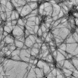 currentsinbiology:  Low levels of toxic proteins linked to brain diseases, study suggests Neurodegenerative diseases such as Alzheimer’s could be better understood thanks to insight into proteins linked to such conditions, a study suggests. Scientists