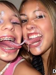 braces-fetish:  Incredible braces covered in cum… see more live on webcam www.afreecamsecret.com