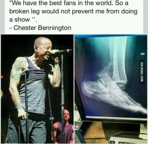 xxxhybridmeteoratheoryxxx: “We have the best fans in the world. So a broken leg would not prev