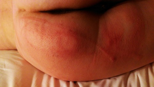 XXX the-masochistic-little:  Daddy had a (painful) photo