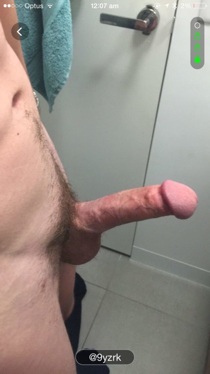 circumcisedperfection:  Perfectly circumcised Aussie. His parents went against the trend and made sure his foreskin was dealt with from the start!