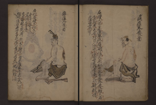 LJS 433 is a 17th century Japanese illustrated treatise on the diagnosis of abscesses and tumors and